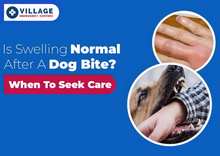 feature image for the dog bites swelling hands