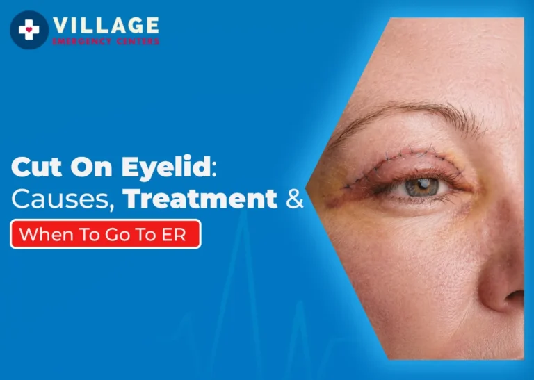Cut on Eyelid – What Causes Eye Lacerations and Injuries?