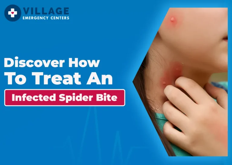 Discover How to Treat an Infected Spider Bite