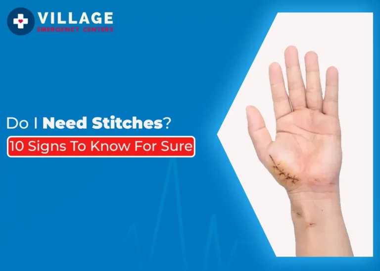 Do I Need Stitches? 10 Signs to Know for Sure