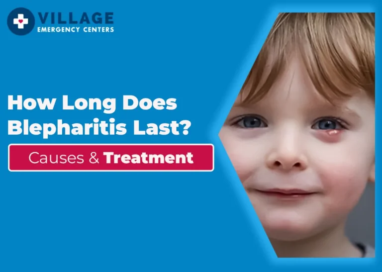 How Long Does Blepharitis Last? Causes & Treatment