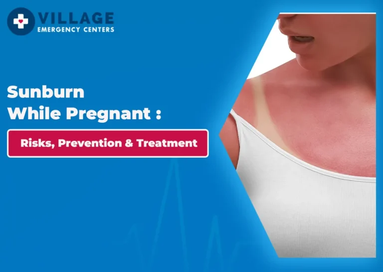 Sunburn While Pregnant: Risks, Prevention & Treatment