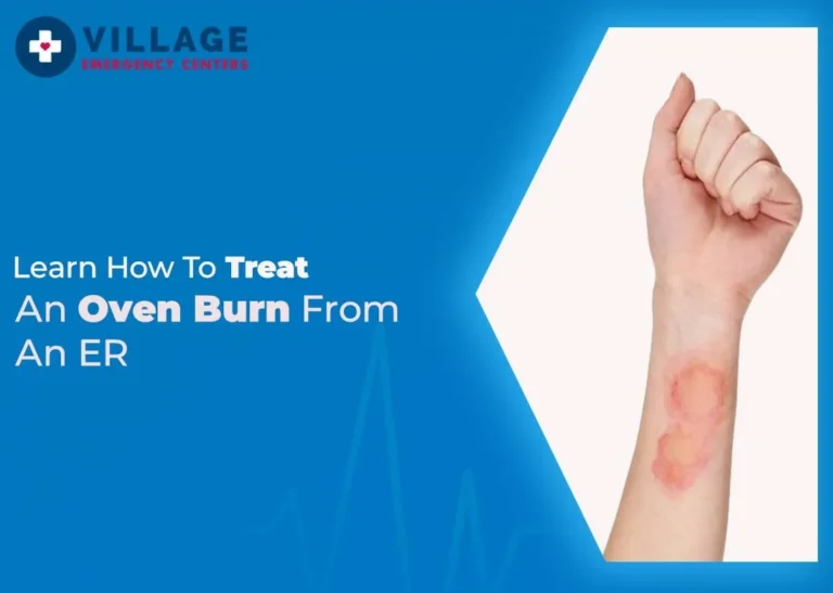 image of a blog about How to Treat an Oven Burn