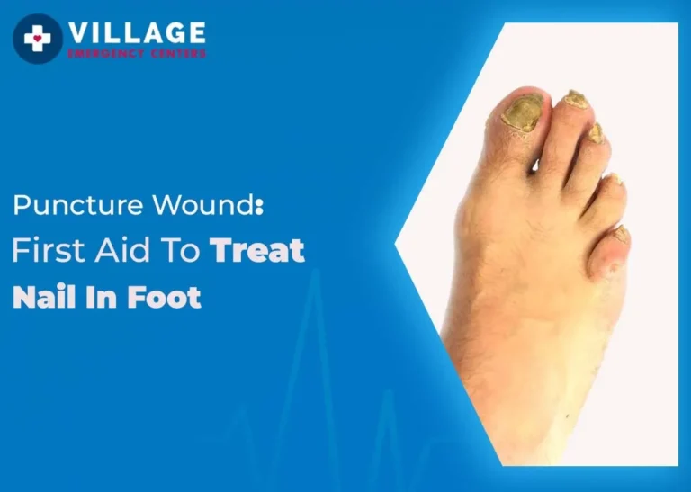 feature image of How to Treat a Nail in Foot