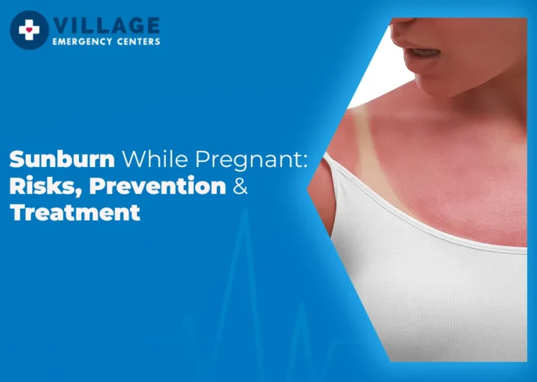 Sunburn While Pregnant: Risks, Prevention & Treatment