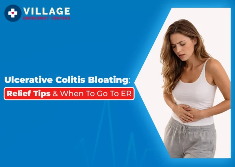 Ulcerative Colitis Bloating: Relief Tips & When to Go to ER