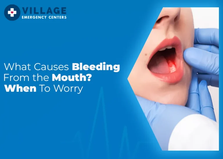 What Causes Bleeding from the Mouth? When to Worry