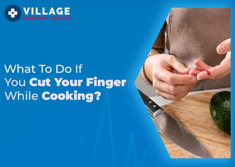 learn with this blog for What To Do If You Cut Your Finger While Cooking?