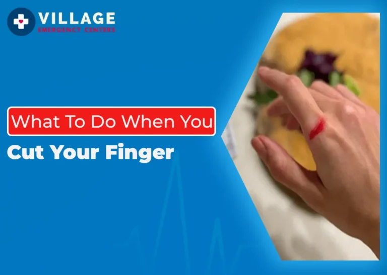 What to Do When You Cut Your Finger?