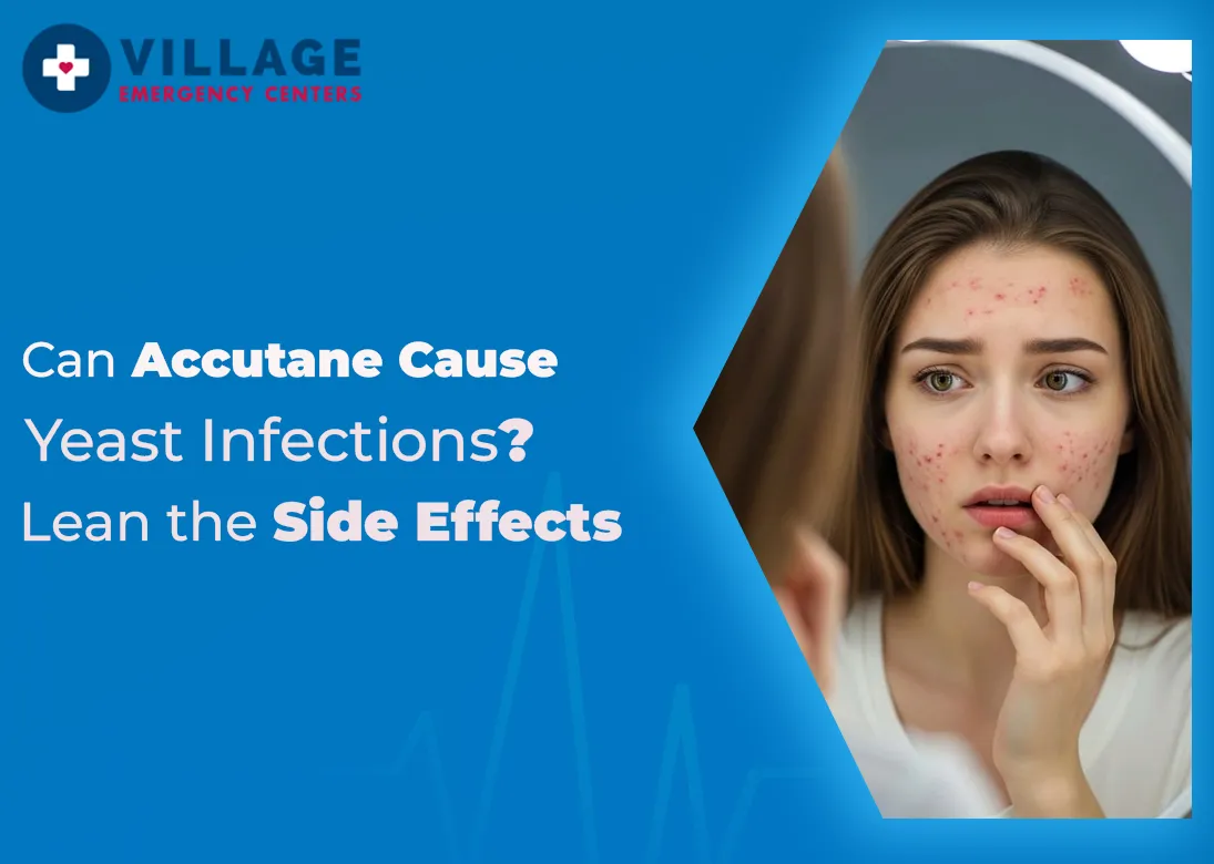 Can Accutane Cause Yeast Infections? Lean the Side Effects