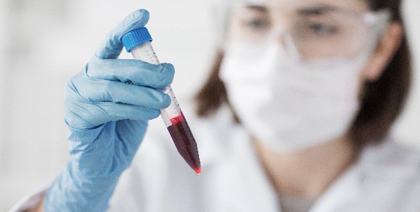 what are the different ways to get a blood test