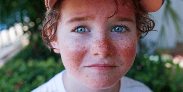 Child with sunburn