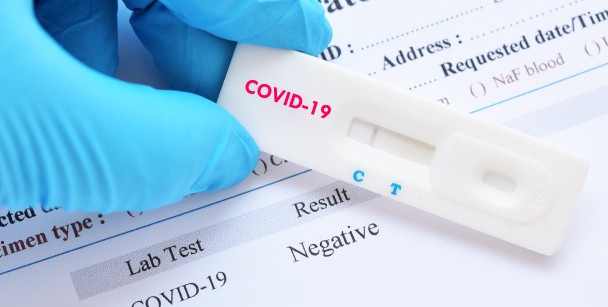 A negative COVID-19 test at an emergency room in Houston, TX 
