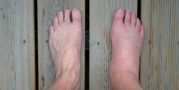 Sharp, Stabbing Foot Pain Symptoms, Causes & Common Questions | Buoy