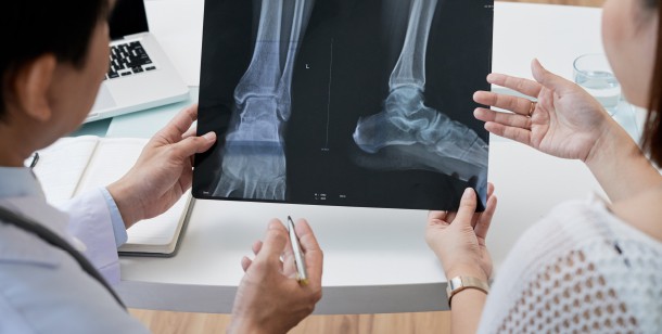 when to see a doctor for severe ankle sprain