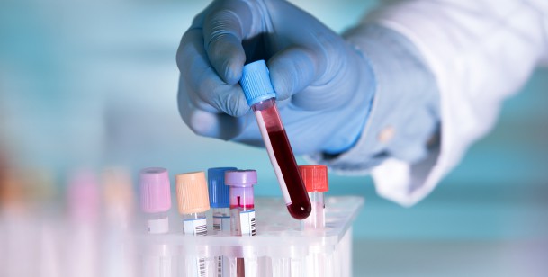 blood test to determine pregnancy