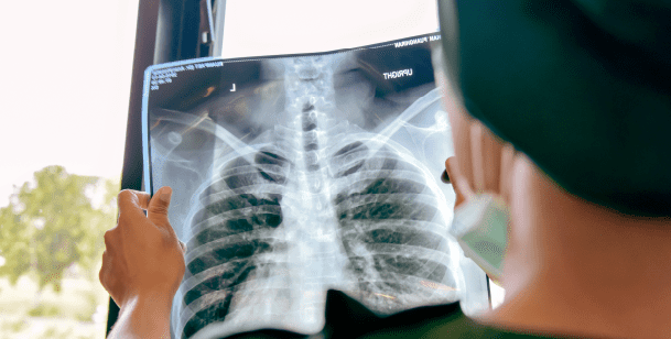 x-rays may be used to diagnose pneumonia