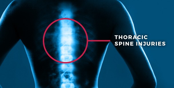 Thoracic Spine Injuries.