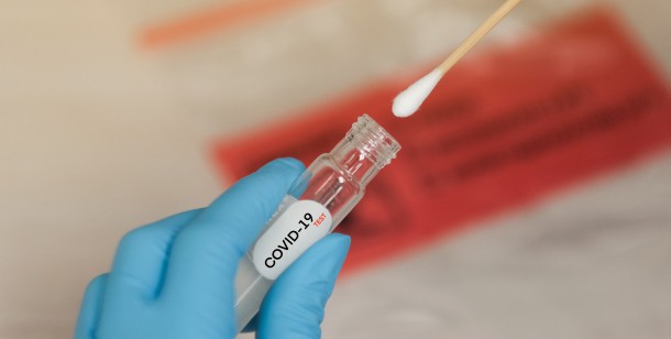 Tests Available for Coronavirus