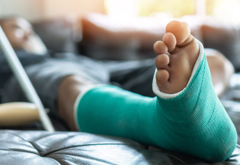 A Network of Emergency Rooms Explains: Signs a Broken Bone is Not Healing