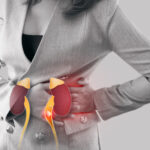 Risk for Kidney Infections