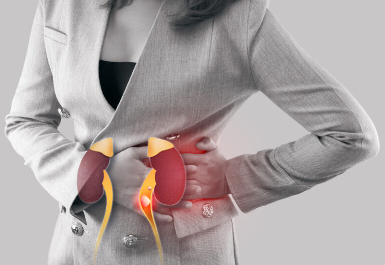 A Network of Emergency Rooms Explains: What are the Symptoms of a Kidney Infection?