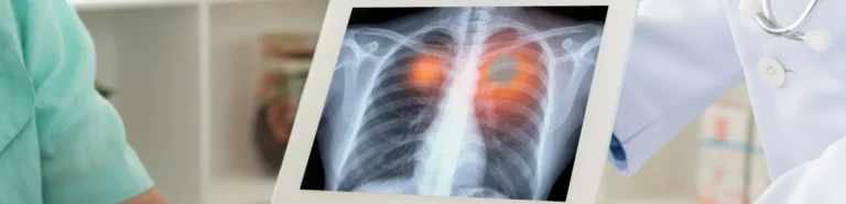 What Does a Chest X-ray Show?