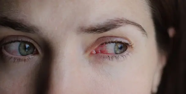 A close-up of a woman with red eyes in Houston, TX