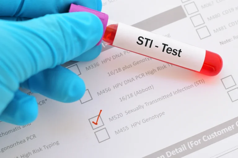 Who Should Be Tested For STD’s?