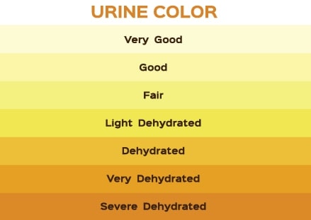 Shades of urine in Houston, TX