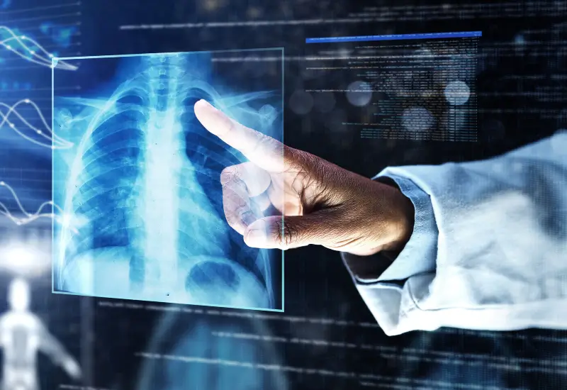 A doctor reviews x-rays of a patient's lungs in Houston, TX