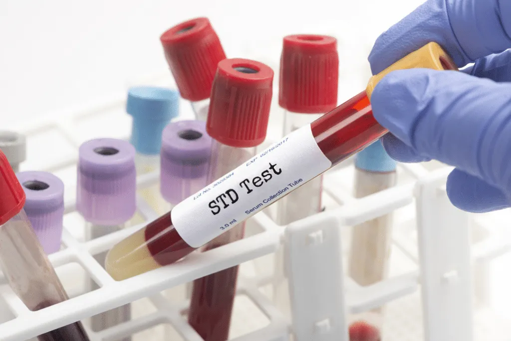 std testing and treatment in village emergency centre