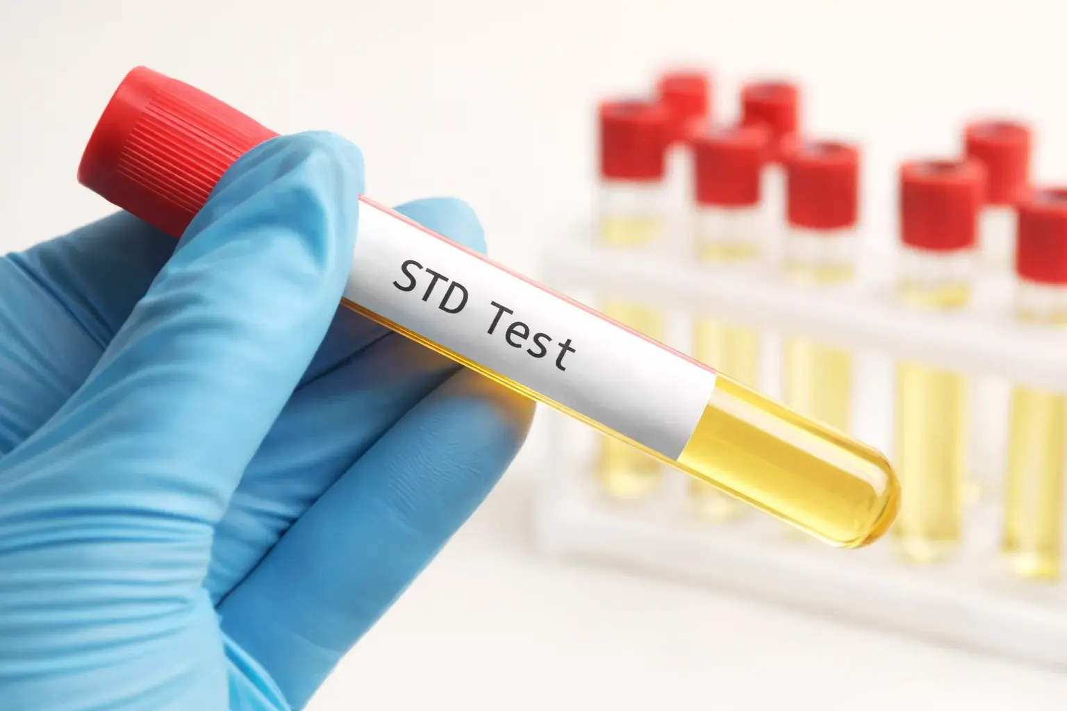 Hand in a gloved medical glove holding a test tube labeled STD Test for STD testing in Jersey Village